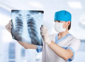 Ung thư phổi dấu hiệu triệu chứng phương pháp điều trị tốt nhất (3)