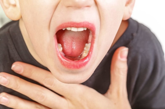 Ung thư vòm họng nguyên nhân dấu hiệu triệu chứng ung thư hòm họng phương pháp điều trị hiệu quả nhất (2)